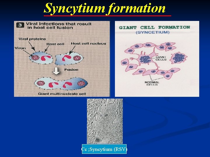 Syncytium formation Cc ; Syncytium (RSV) 