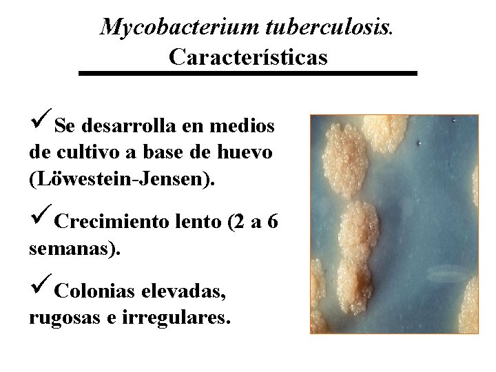 Mycobacterium tuberculosis. Características üSe desarrolla en medios de cultivo a base de huevo (Löwestein-Jensen).