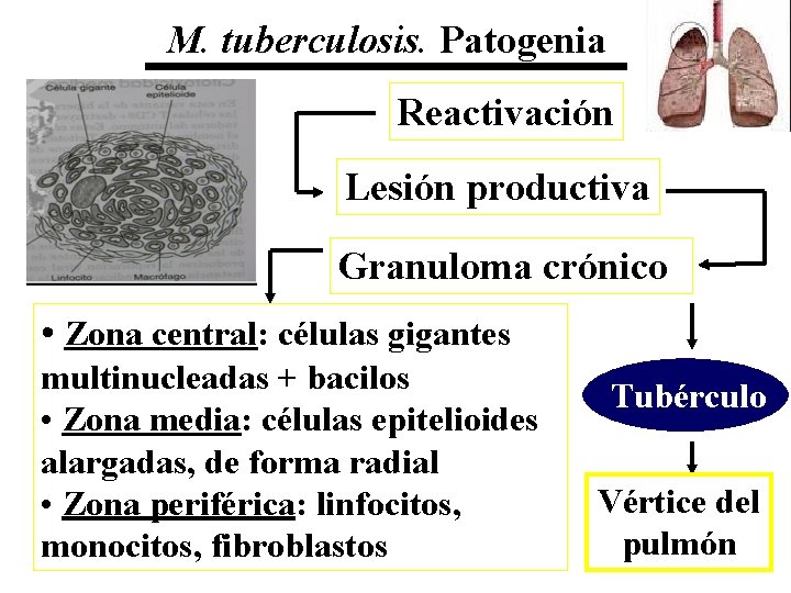 M. tuberculosis. Patogenia Reactivación Lesión productiva Granuloma crónico • Zona central: células gigantes multinucleadas