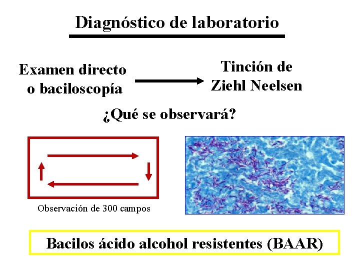 Diagnóstico de laboratorio Examen directo o baciloscopía Tinción de Ziehl Neelsen ¿Qué se observará?