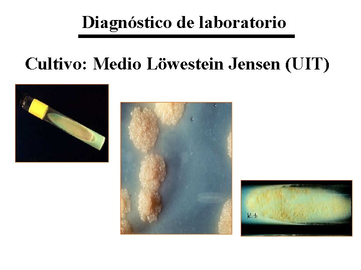 Diagnóstico de laboratorio Cultivo: Medio Löwestein Jensen (UIT) 