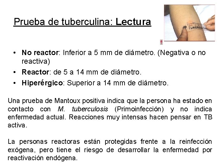 Prueba de tuberculina: Lectura • No reactor: Inferior a 5 mm de diámetro. (Negativa