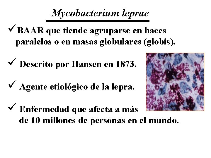 Mycobacterium leprae üBAAR que tiende agruparse en haces paralelos o en masas globulares (globis).