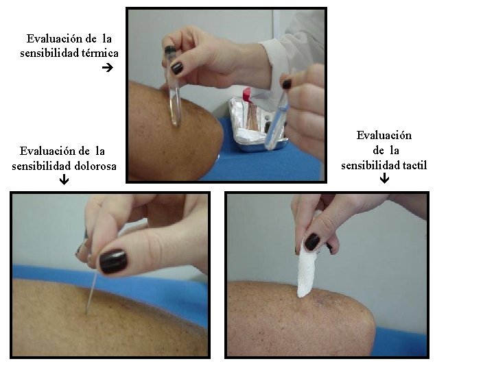 Evaluación de la sensibilidad térmica Evaluación de la sensibilidad dolorosa Evaluación de la sensibilidad