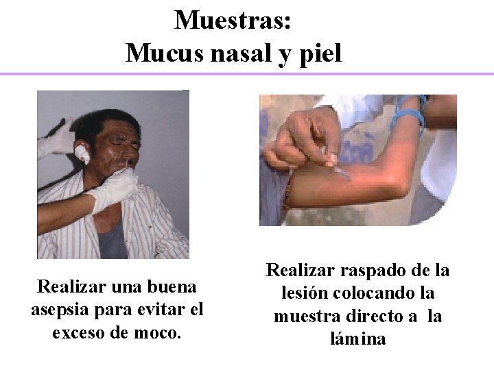 Muestras: Mucus nasal y piel Realizar una buena asepsia para evitar el exceso de