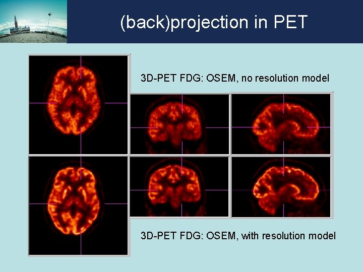 (back)projection in PET 3 D-PET FDG: OSEM, no resolution model 3 D-PET FDG: OSEM, (back)projection in PET 3 D-PET FDG: OSEM, no resolution model 3 D-PET FDG: OSEM,