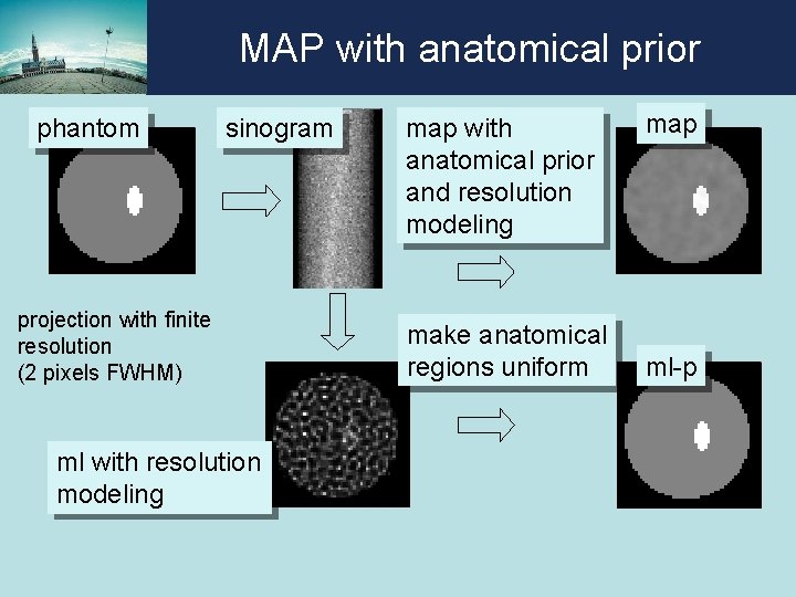 MAP with anatomical prior phantom sinogram projection with finite resolution (2 pixels FWHM) ml MAP with anatomical prior phantom sinogram projection with finite resolution (2 pixels FWHM) ml