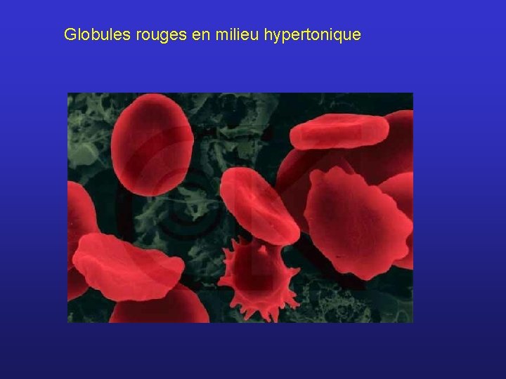 Globules rouges en milieu hypertonique 