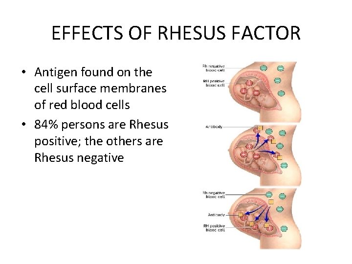 EFFECTS OF RHESUS FACTOR • Antigen found on the cell surface membranes of red