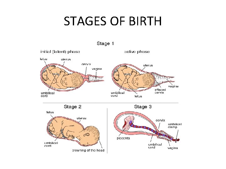 STAGES OF BIRTH 