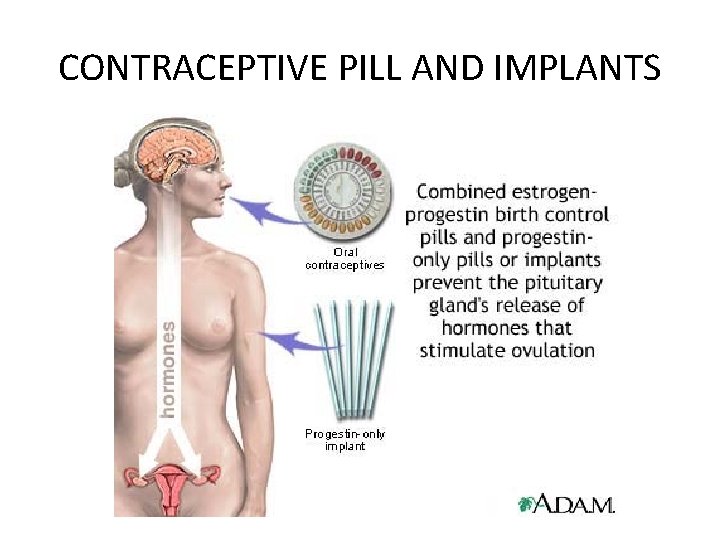 CONTRACEPTIVE PILL AND IMPLANTS 