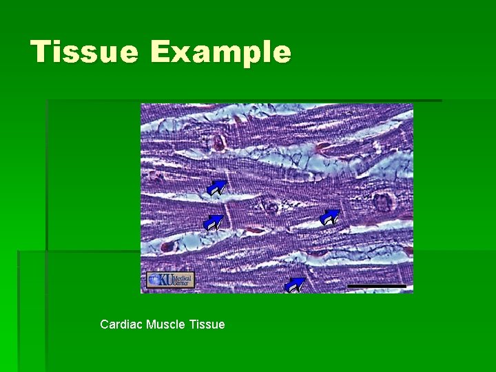 Tissue Example Cardiac Muscle Tissue 