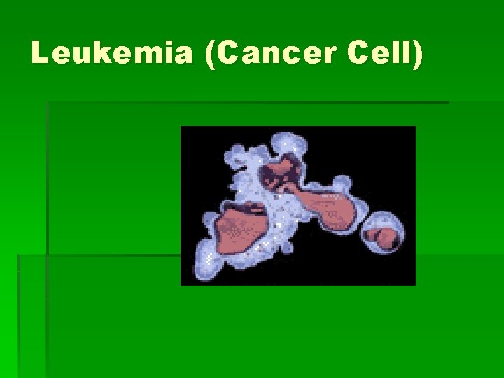 Leukemia (Cancer Cell) 