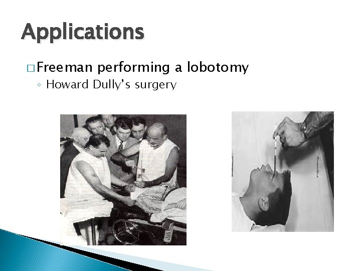 Applications � Freeman performing a lobotomy ◦ Howard Dully’s surgery 