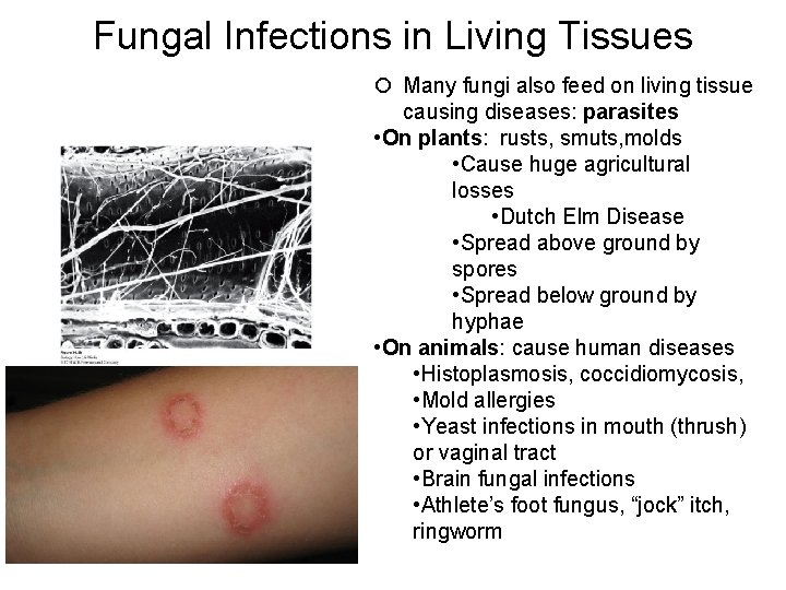 Fungal Infections in Living Tissues Many fungi also feed on living tissue causing diseases: