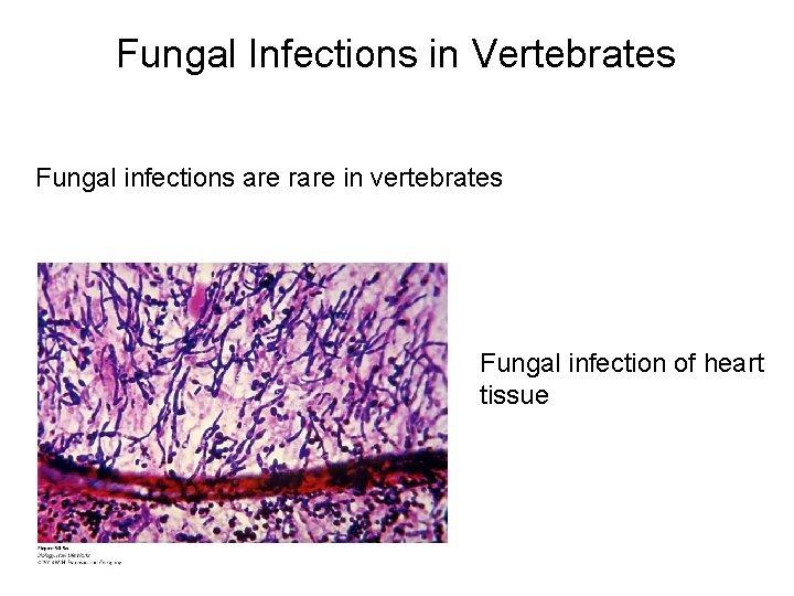 Fungal Infections in Vertebrates Fungal infections are rare in vertebrates Fungal infection of heart
