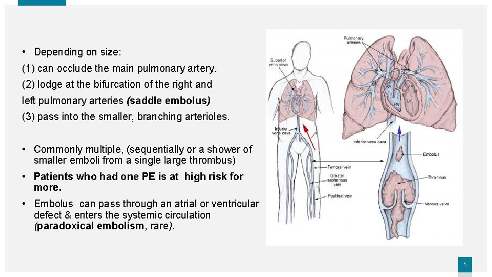  • Depending on size: (1) can occlude the main pulmonary artery. (2) lodge