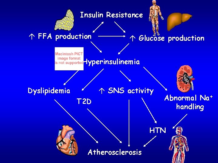 Insulin Resistance á FFA production á Glucose production Hyperinsulinemia Dyslipidemia á SNS activity T