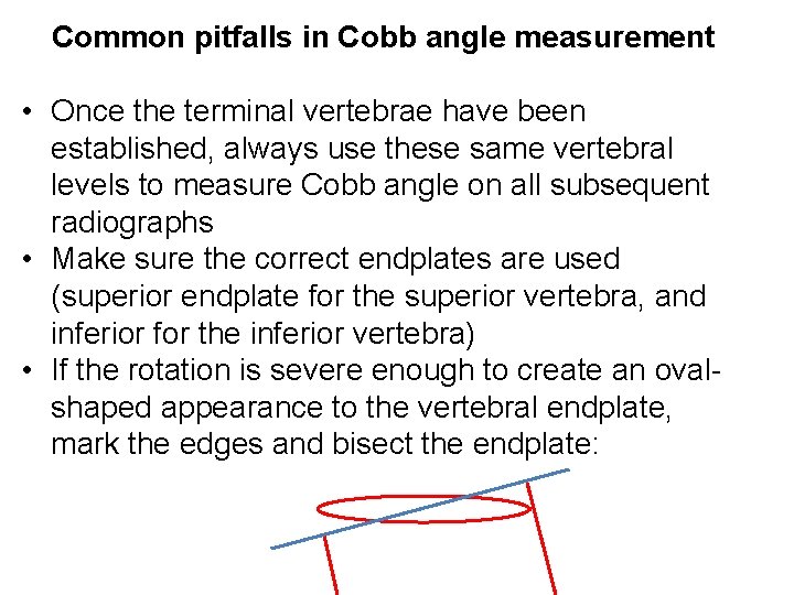 Common pitfalls in Cobb angle measurement • Once the terminal vertebrae have been established,
