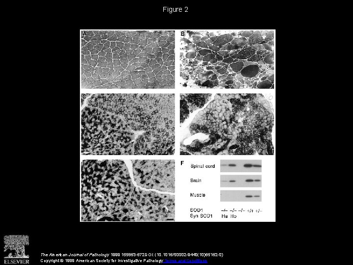 Figure 2 The American Journal of Pathology 1999 155663 -672 DOI: (10. 1016/S 0002