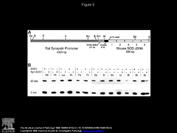 Figure 5 The American Journal of Pathology 1999 155663 -672 DOI: (10. 1016/S 0002