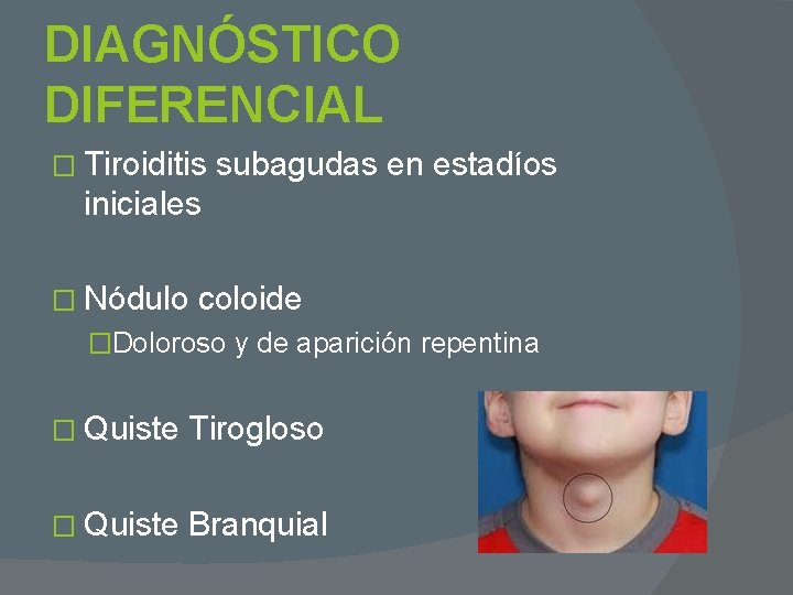DIAGNÓSTICO DIFERENCIAL � Tiroiditis subagudas en estadíos iniciales � Nódulo coloide �Doloroso y de