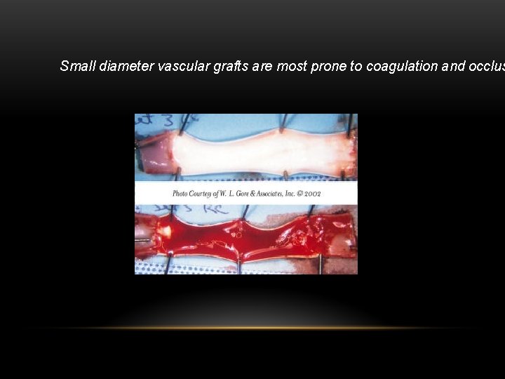 Small diameter vascular grafts are most prone to coagulation and occlus 