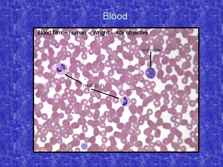 Blood film -- human – Wright – 40 x objective monocyte neutrophils 