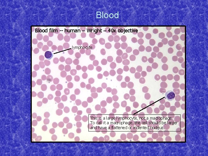 Blood film -- human – Wright – 40 x objective lymphocyte This is a