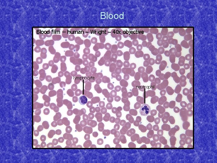 Blood film -- human – Wright – 40 x objective lymphocyte neutrophil 