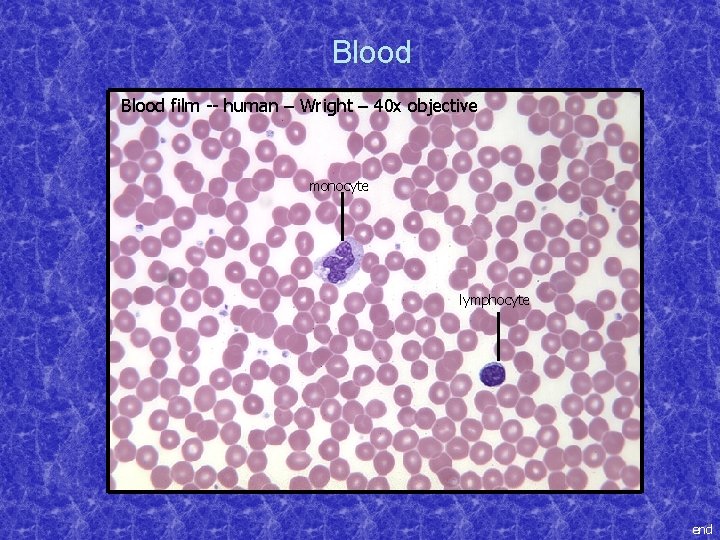 Blood film -- human – Wright – 40 x objective monocyte lymphocyte end 