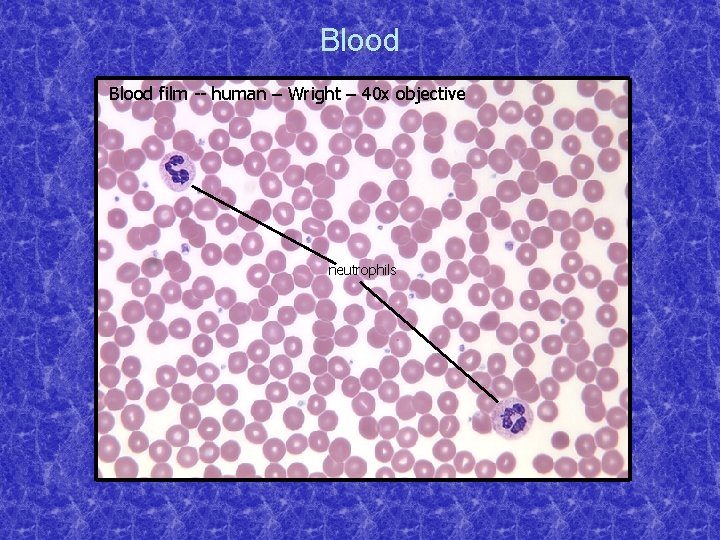 Blood film -- human – Wright – 40 x objective neutrophils 
