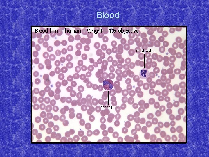 Blood film -- human – Wright – 40 x objective neutrophil eosinophil 