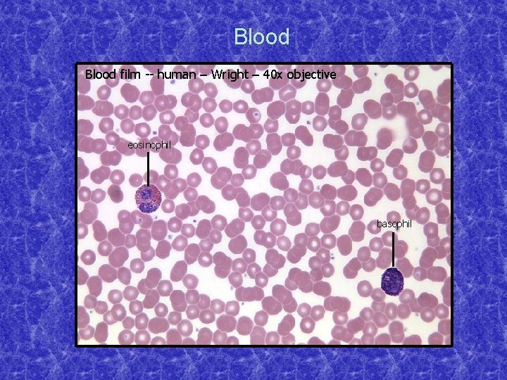 Blood film -- human – Wright – 40 x objective eosinophil basophil 