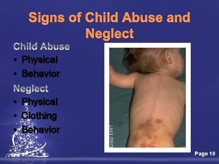 Signs of Child Abuse and Neglect • Physical • Behavior • • • Physical