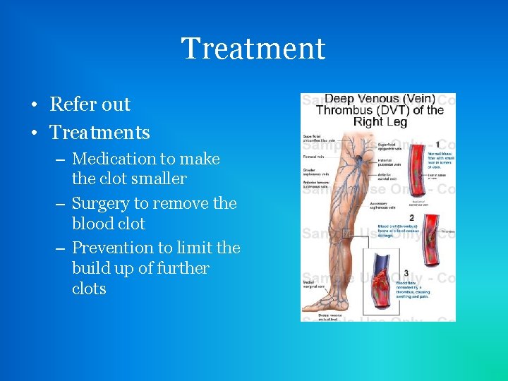 Treatment • Refer out • Treatments – Medication to make the clot smaller –