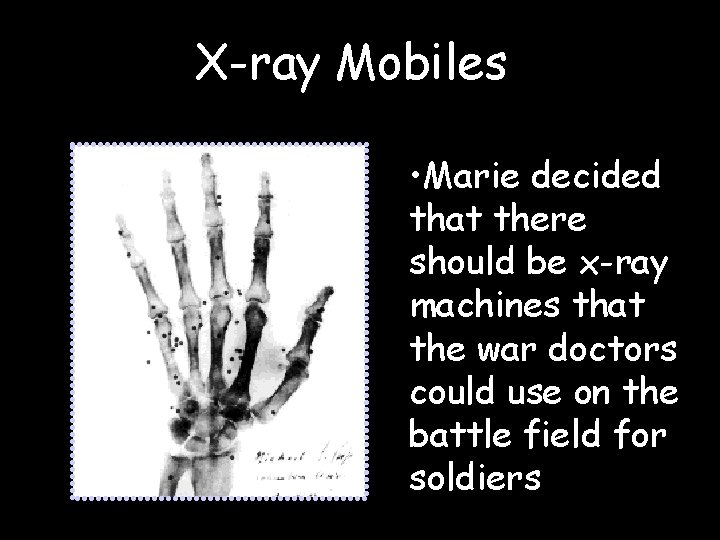 X-ray Mobiles • Marie decided that there should be x-ray machines that the war
