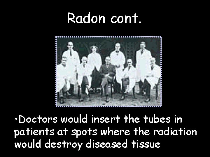 Radon cont. • Doctors would insert the tubes in patients at spots where the