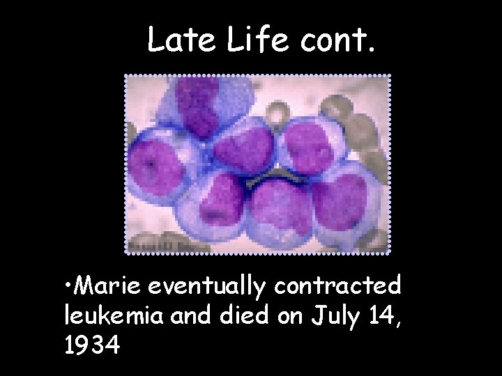 Late Life cont. • Marie eventually contracted leukemia and died on July 14, 1934