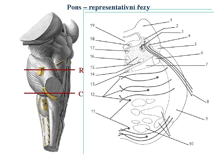 Pons – representativní řezy R C 