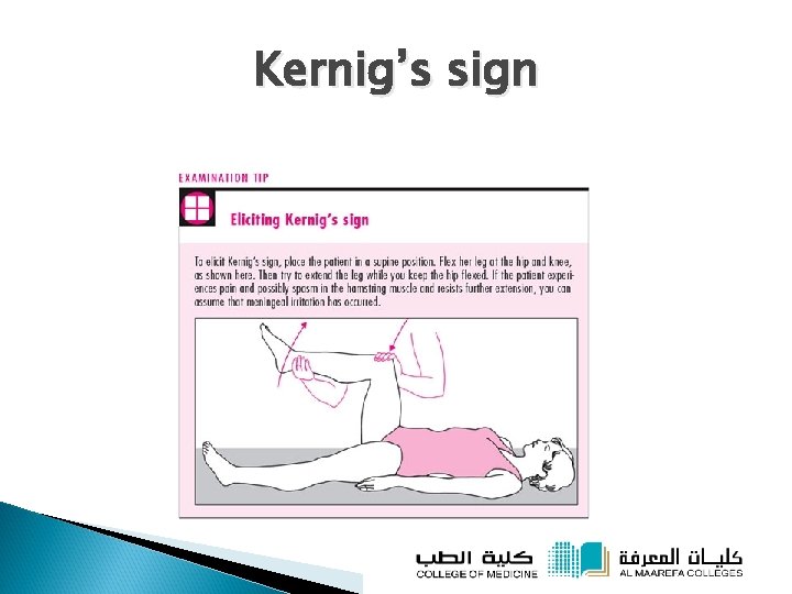 Kernig’s sign 