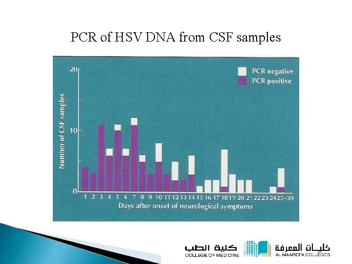 PCR of HSV DNA from CSF samples 