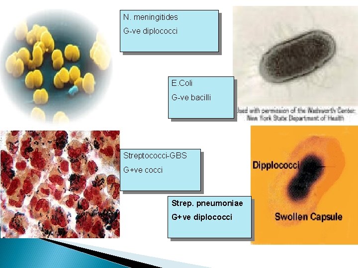 N. meningitides G-ve diplococci E. Coli G-ve bacilli Streptococci-GBS G+ve cocci Strep. pneumoniae G+ve
