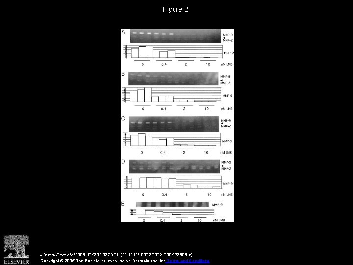 Figure 2 J Invest Dermatol 2005 124331 -337 DOI: (10. 1111/j. 0022 -202 X.