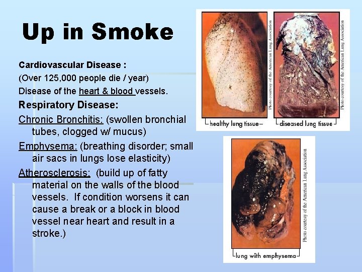 Up in Smoke Cardiovascular Disease : (Over 125, 000 people die / year) Disease