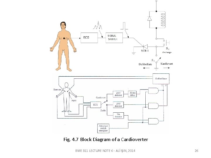 Fig. 4. 7 Block Diagram of a Cardioverter BME 311 LECTURE NOTE 6 -