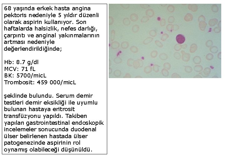 68 yaşında erkek hasta angina pektoris nedeniyle 5 yıldır düzenli olarak aspirin kullanıyor. Son