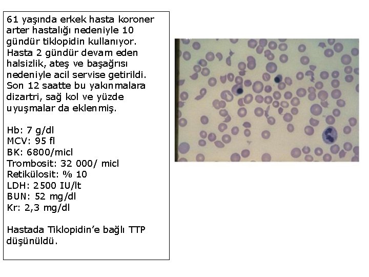 61 yaşında erkek hasta koroner arter hastalığı nedeniyle 10 gündür tiklopidin kullanıyor. Hasta 2