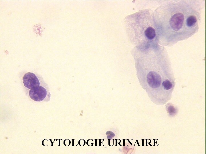 CYTOLOGIE URINAIRE 