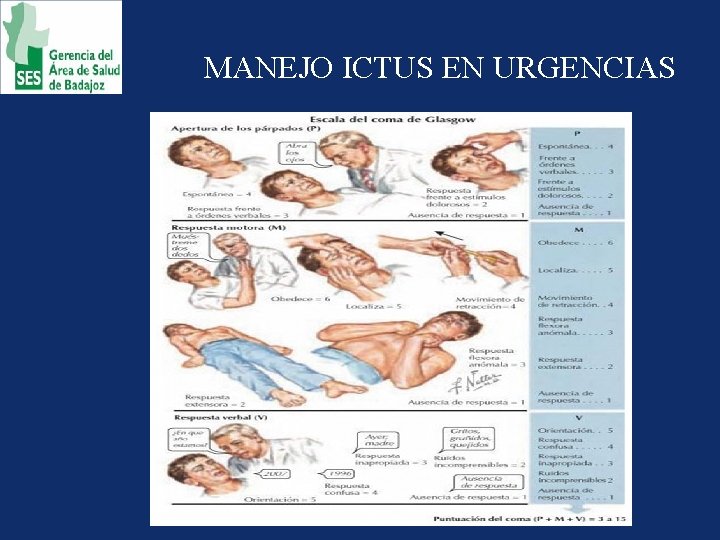 MANEJO ICTUS EN URGENCIAS 